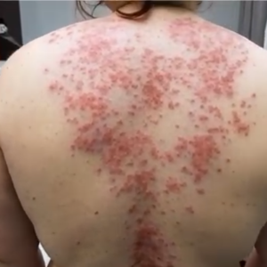 Unexpected Risks of Sleeping With Certain Individuals Screenshot_1