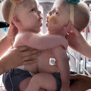 594958474_122214369284113433_2174202972819592631_n