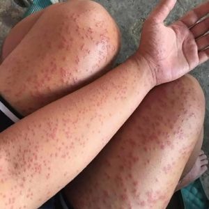 606437887_122253284468083645_2028187397762256878_n